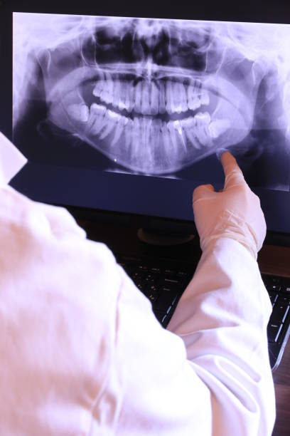 Best Emergency Wisdom Teeth Removal in Black Rock, NM