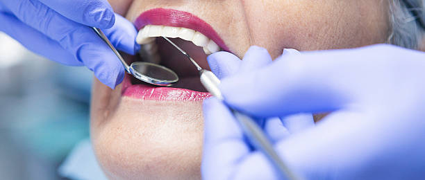 Best Emergency Dental Care for Broken or Chipped Teeth in Black Rock, NM